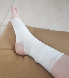 leg bandage 2